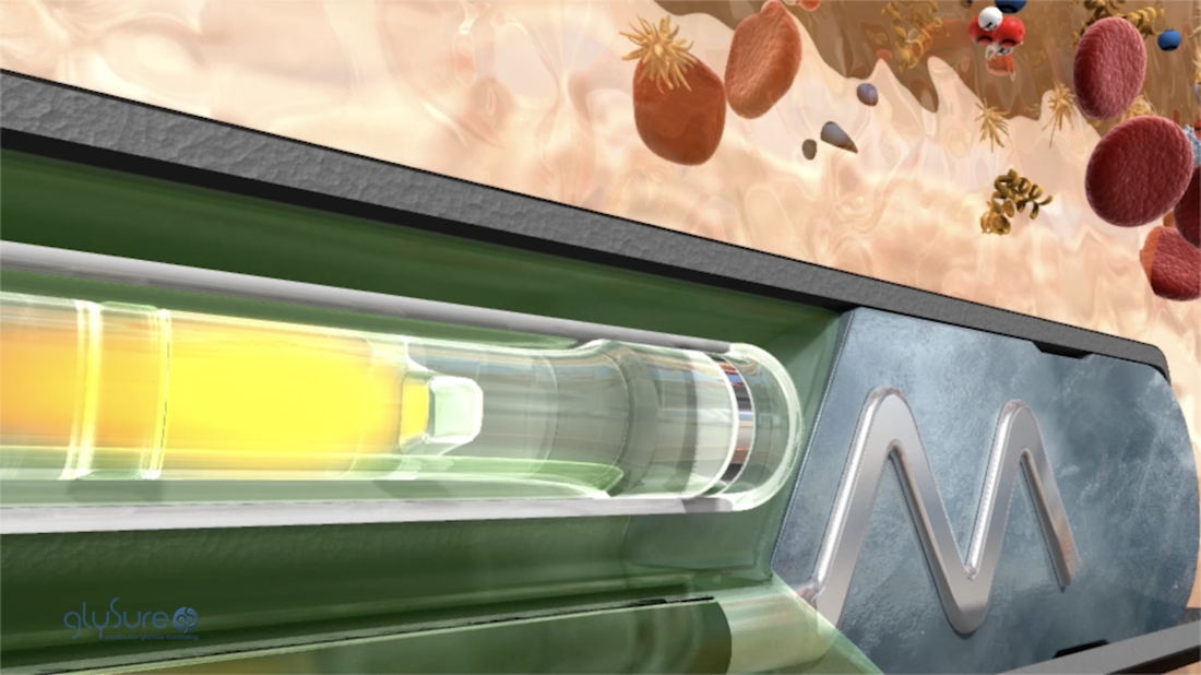 Glysure animated video still